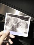 究極核彈 推特39萬粉絲網紅孕婦『雪莉』最強私拍 啪啪露出擠奶全操齊 高清